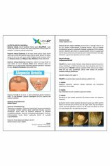 Nidasit Saçkıran Losyon Alopecia Areata 50 ml