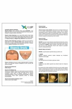 Nidasit Saçkıran Losyon Alopecia Areata 50 ml